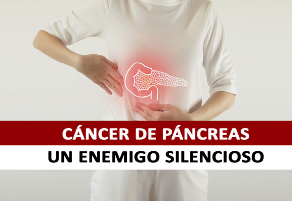 Cáncer de Páncreas Cáncer de Páncreas