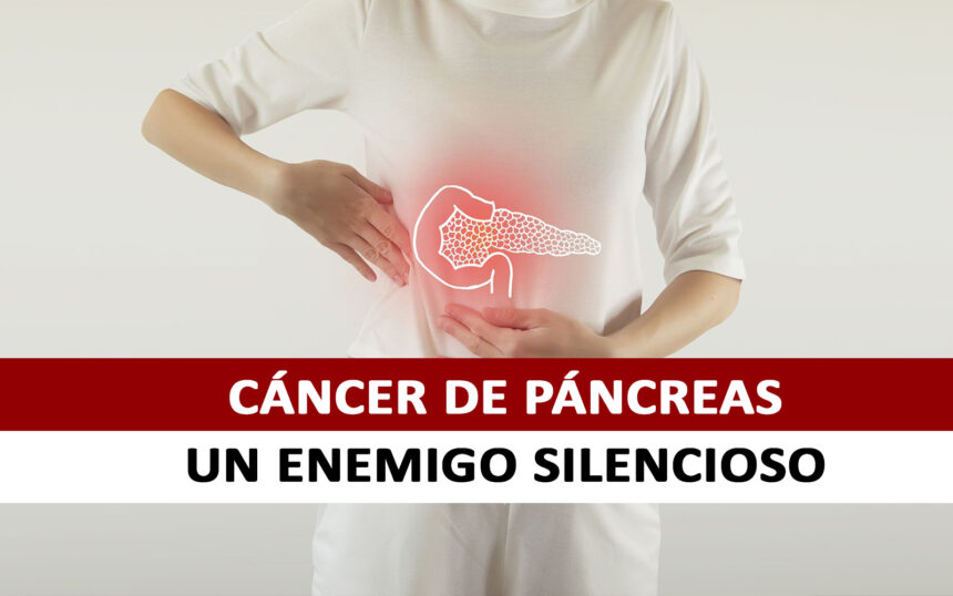 Cáncer de Páncreas