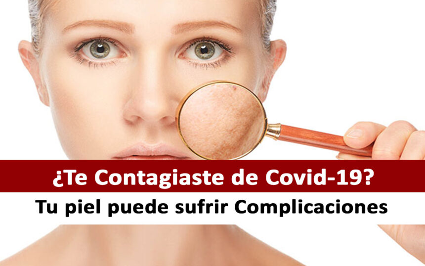 Complicaciones en la piel por el COVID-19