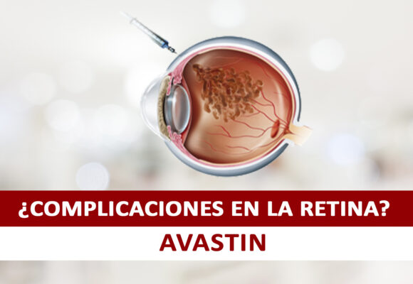 Combate las complicaciones en la Retina con el AVASTIN Combate las complicaciones en la Retina con el AVASTIN