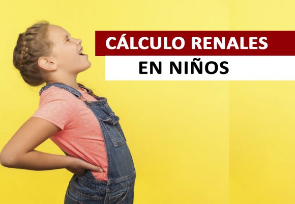 Cálculos Renales en Niños Cálculos Renales en Niños