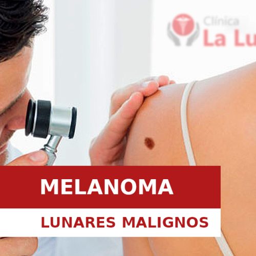 MELANOMA: CUANDO LOS LUNARES SON MALIGNOS MELANOMA: CUANDO LOS LUNARES SON MALIGNOS